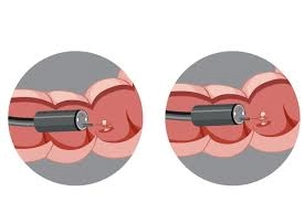 Hızlı İyileşmek İçin